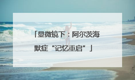 显微镜下：阿尔茨海默症“记忆重启”